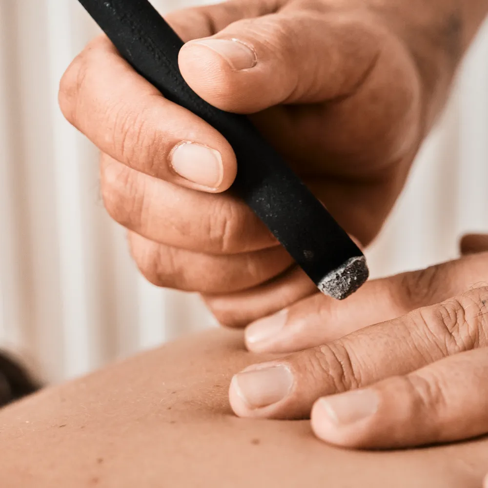 Trattamento di moxibustione, medicina tradizionale cinese